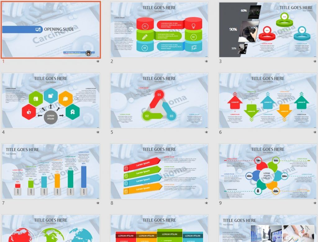 Carcinoma PPT by SageFox Carcinoma PPT by SageFox